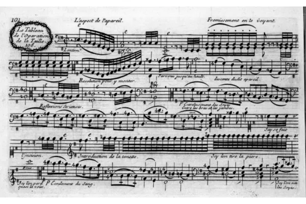 Fragment uit Le Tableau de l’opération de la taille (1725) van Marin Marais